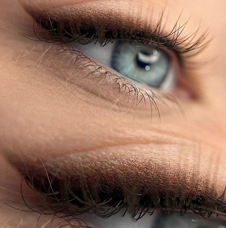 Коррекция перманента верхнего века