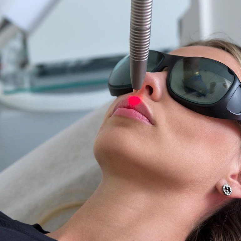 Удаление губ лазером