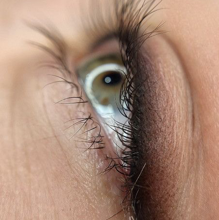 Рефреш глаз