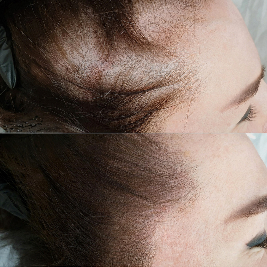 АКЦИЯ!  Трихопигментация.Загущение волос(висков)