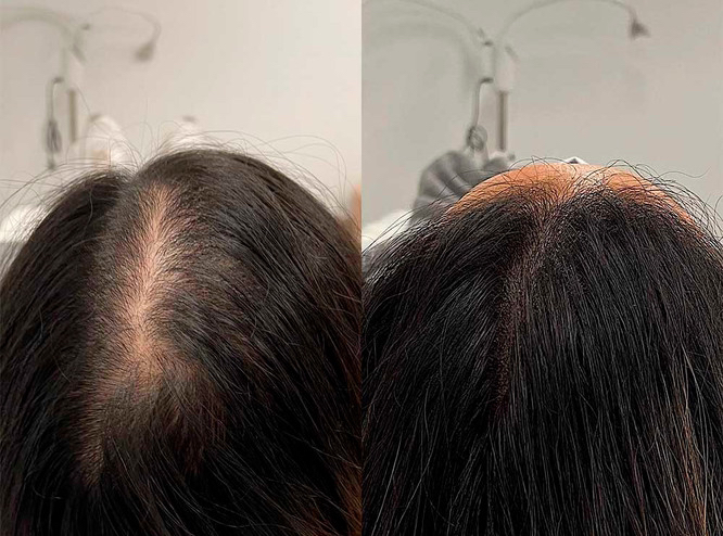 АКЦИЯ! Трихопигментация.Прикорневое загущение