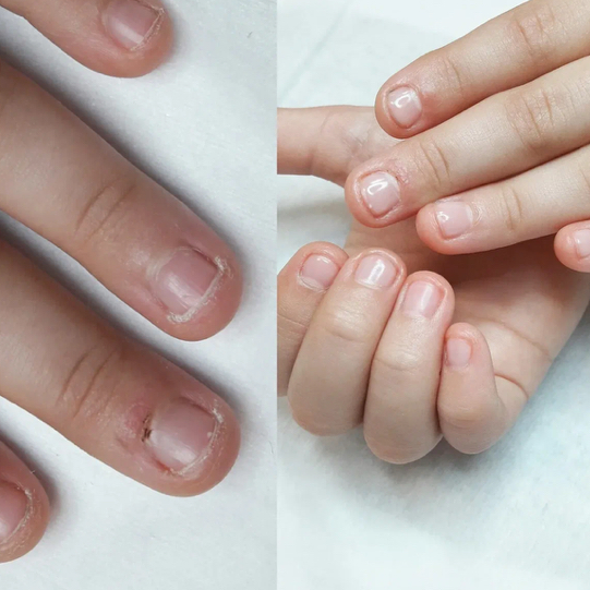 Детский гигиенический маникюр