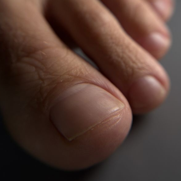 Мужской педикюр (только пальцы)