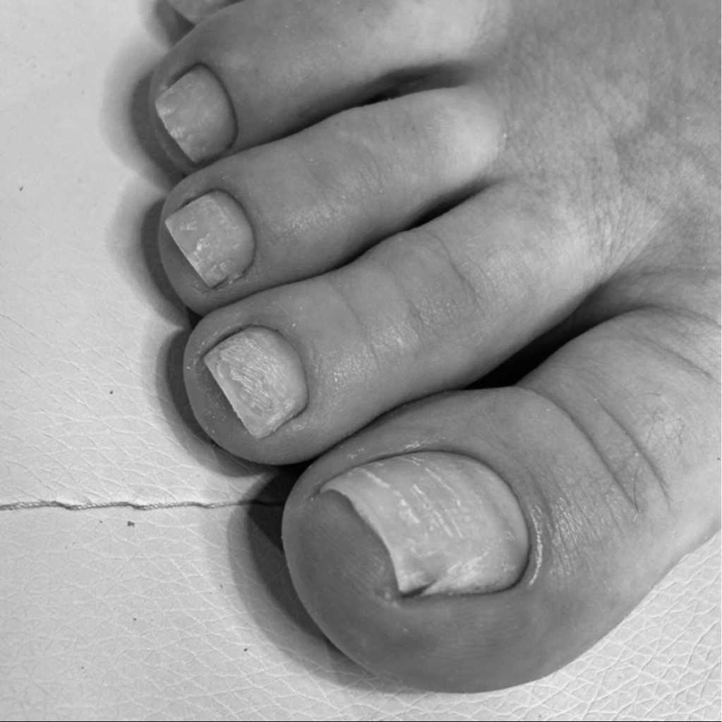 Педикюр Снятие, без покрытия, обработка кутикулы, опил формы