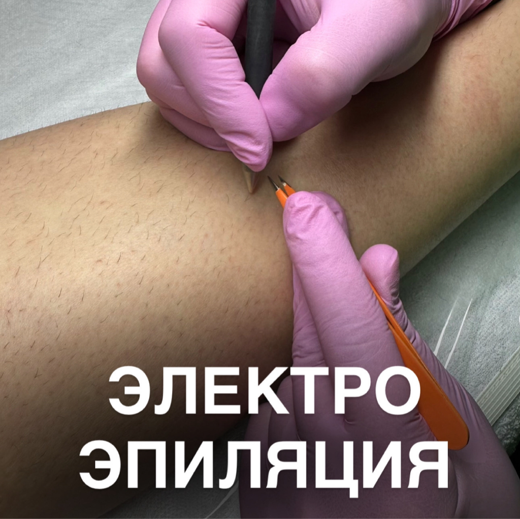 Электроэпиляция 60 мин (муж)