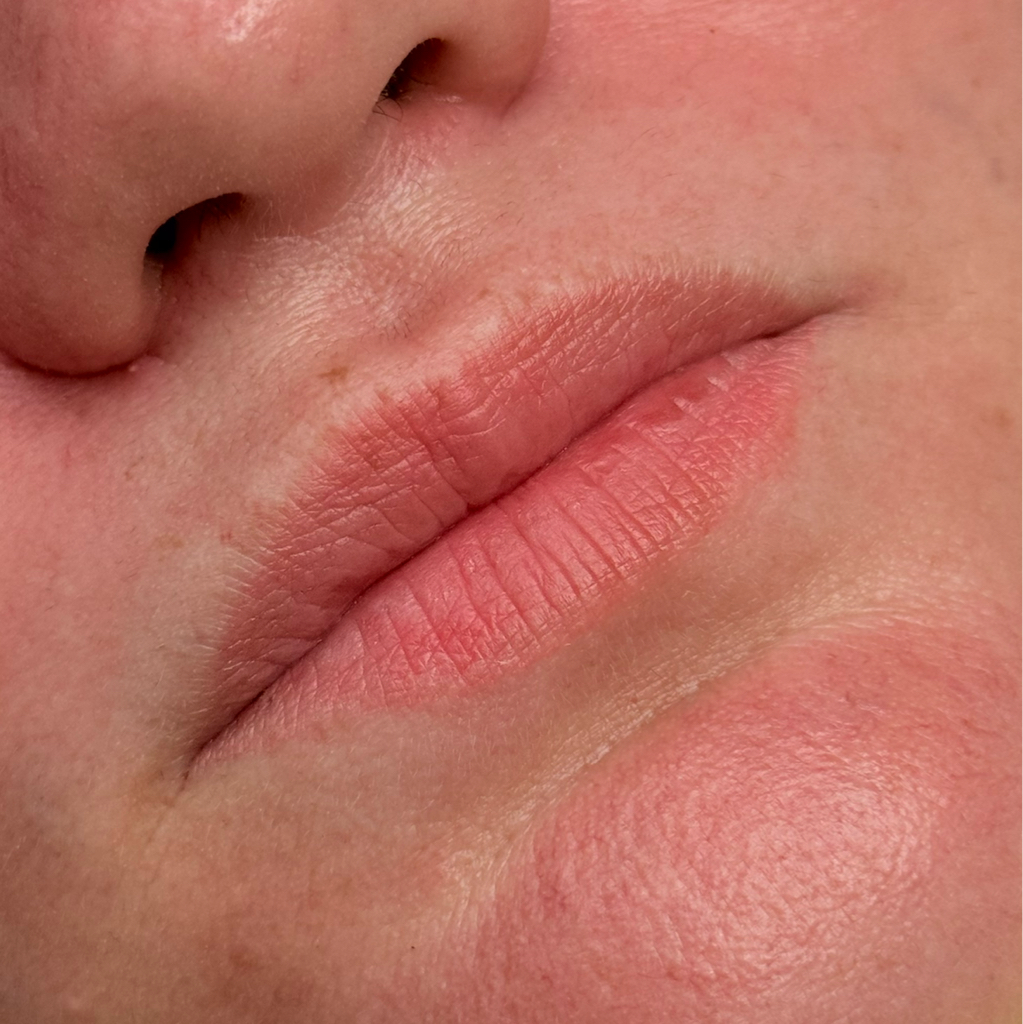 Коррекция перманентного макияжа губ