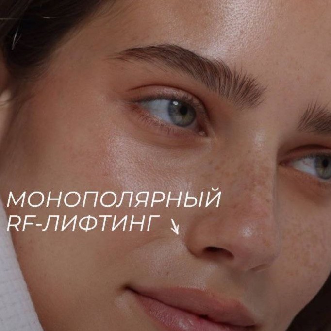 10 сеансов монолифтинг