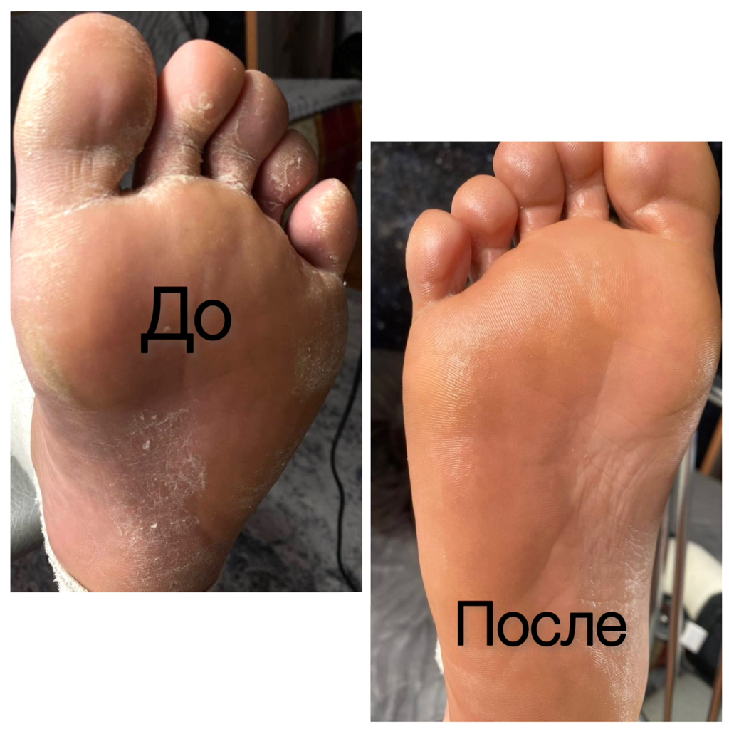 Smart педикюр