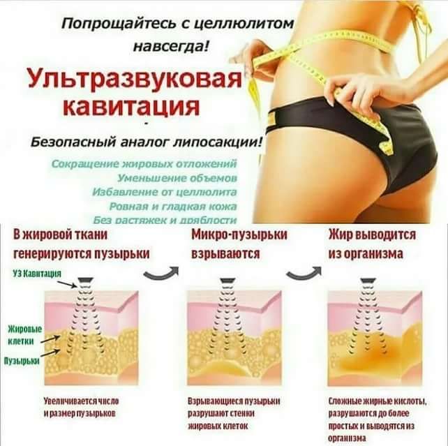 Кавитация