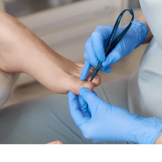 Аппаратный подологический педикюр ( стопа+пальцы) Покрытие лаком в подарок ТОП-МАСТЕР