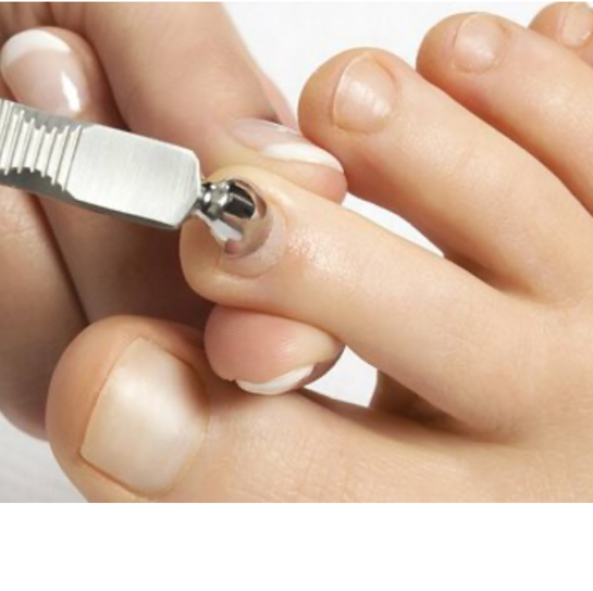 Аппаратная подологическая обработка пальцев, лак в подарок   
ТОП-МАСТЕР