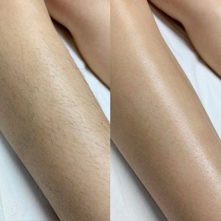 Модель "Ноги"