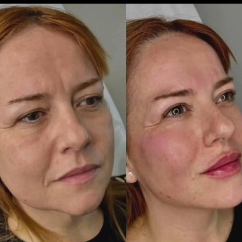 косметолог минус 10 (возраст / вес)