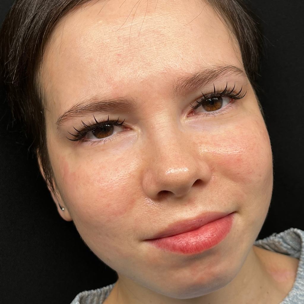 Эффект Лучей