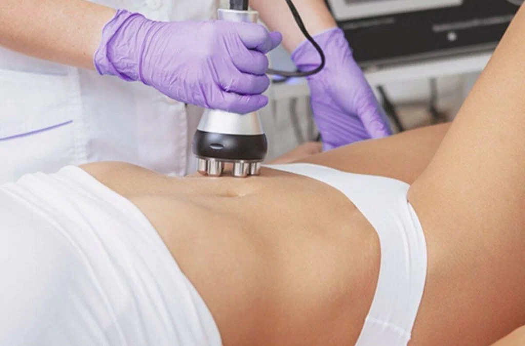 Rf лифтинг 1 зона ( тело)