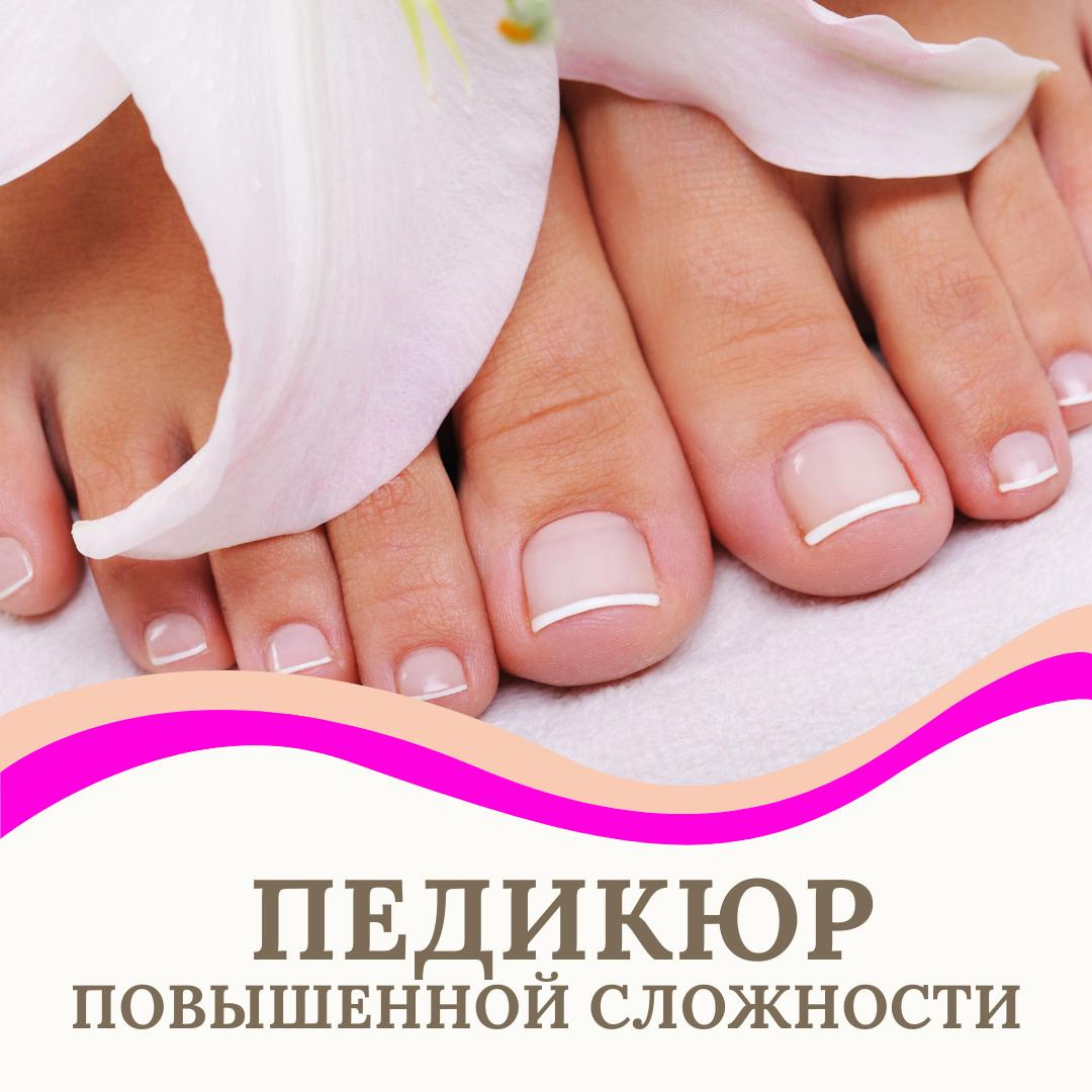 Педикюр повышенной сложностиОбработка грибковой инфекции, гиперкератоза, деформированных, утолщенных ногтей, натоптышей, трещин, тампонада, тейпирова