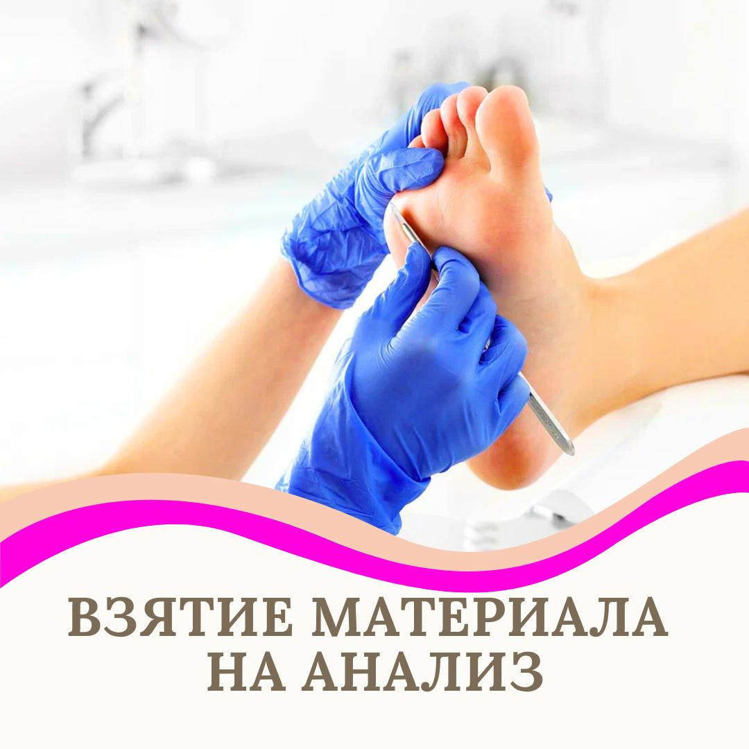 Взятие материала на анализ