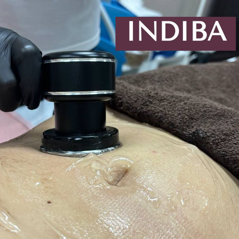 INDIBA (коррекция фигуры)