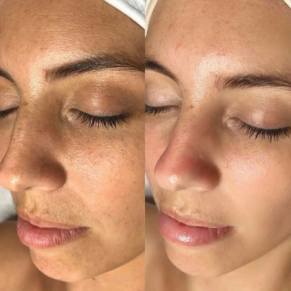 Пилинг Оранжевый Rяbinova