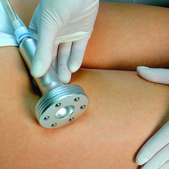 10 вакуумно роликовый массаж