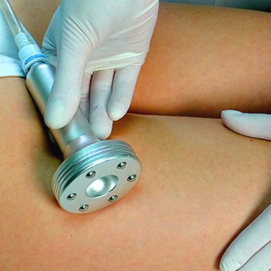 10 вкр +10 липолиз