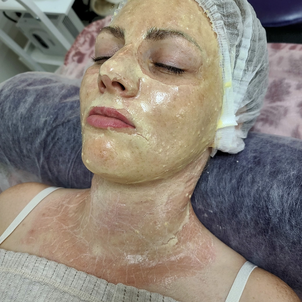 Аминотерапия (