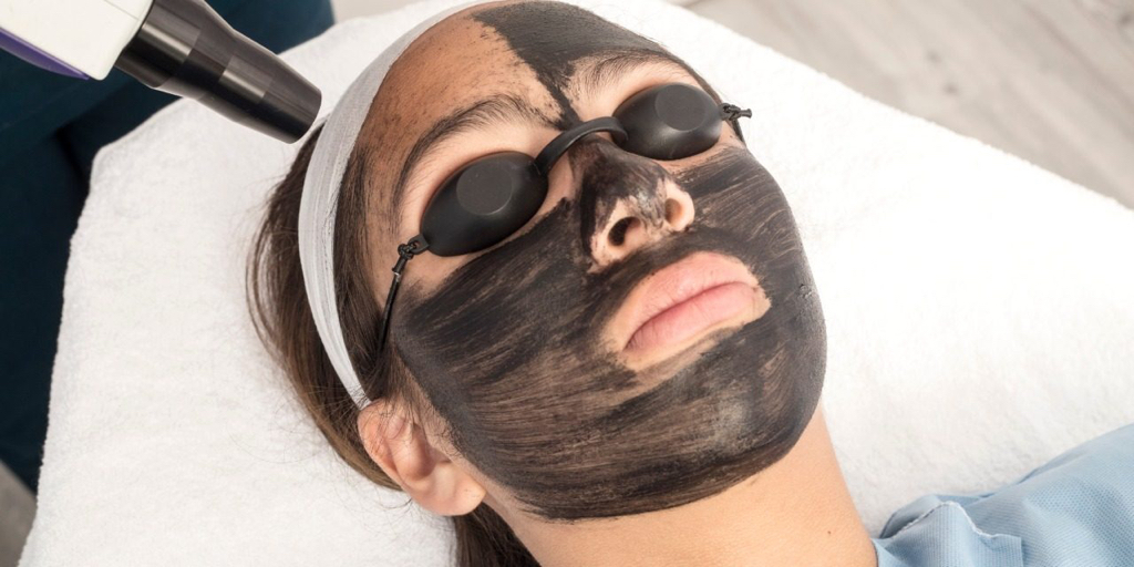 Карбоновый пилинг лица (55 минут)