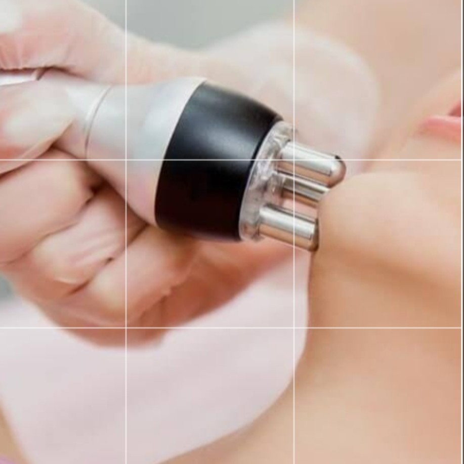 RF шея и зона декольте