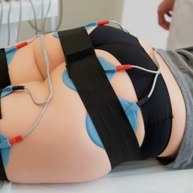 пробная миостимуляция