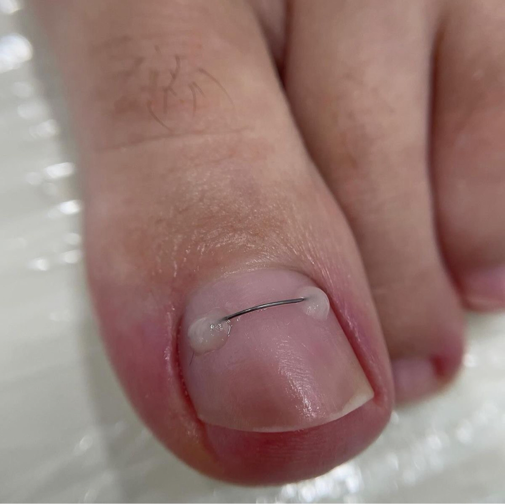 Осмотр подолога