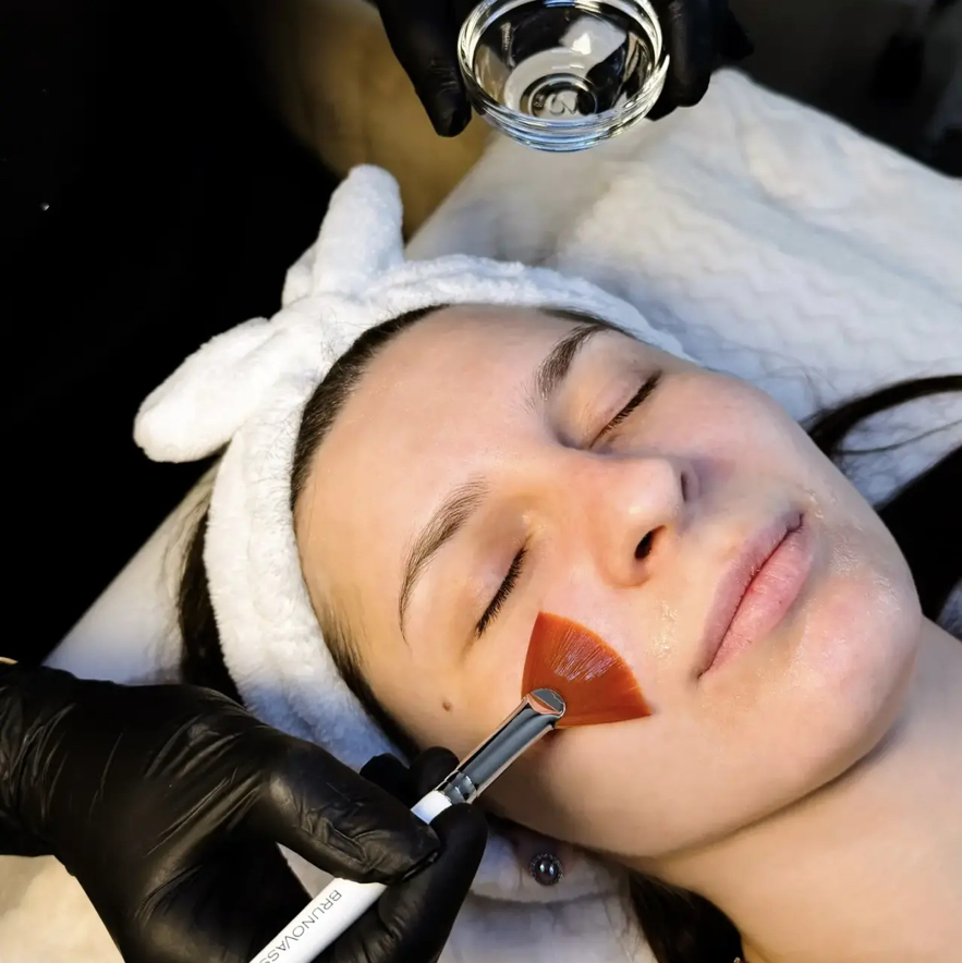 Пилинг химический всесезонный (SIMILDIET, Испания)  одноэтапный