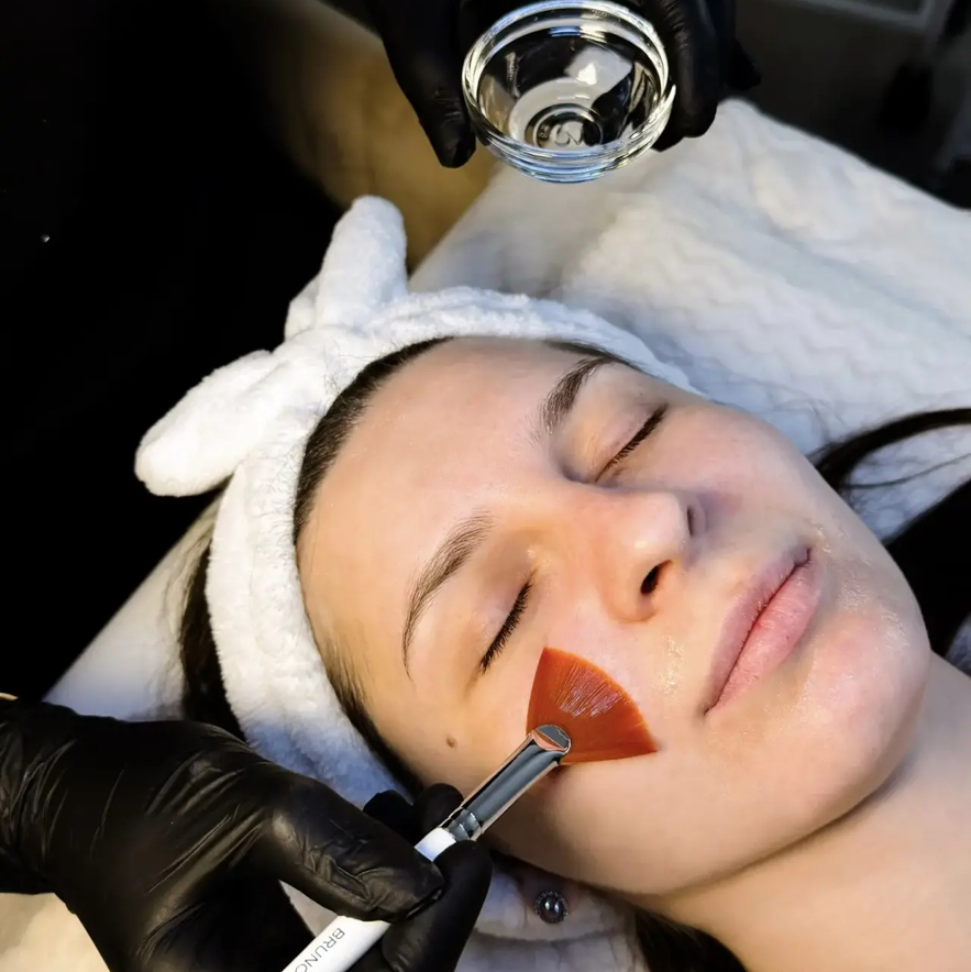 Пилинг химический всесезонный (SIMILDIET, Испания)  двухэтапный