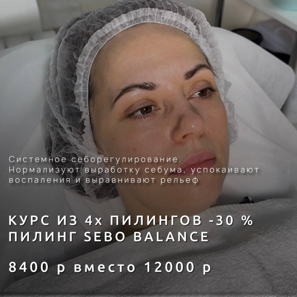 Курс из 4 х себерогулиоующих  пилингов