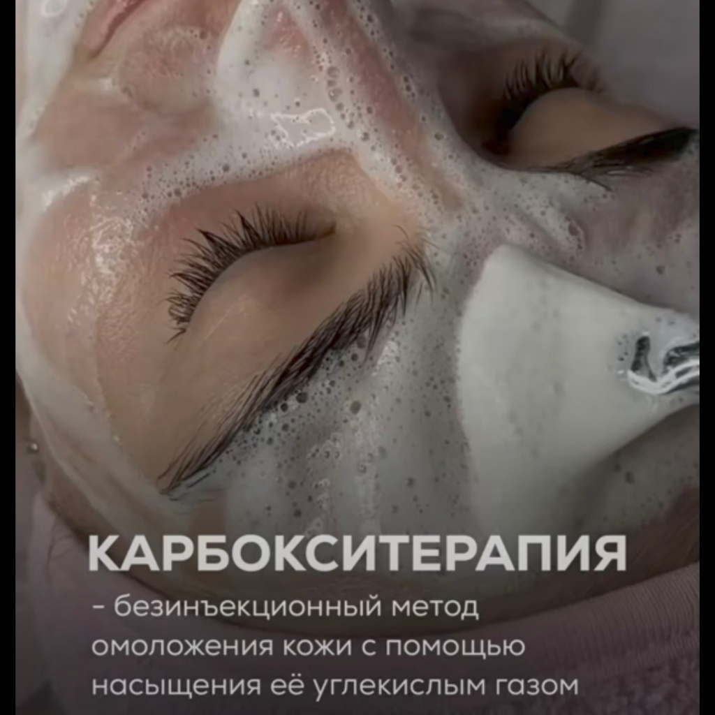 Карбокситерапия/КИСЛОРОДНОЕ преображение