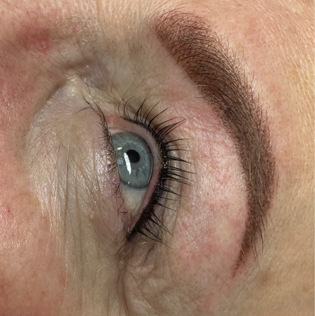 Коррекцию межресничного пространства