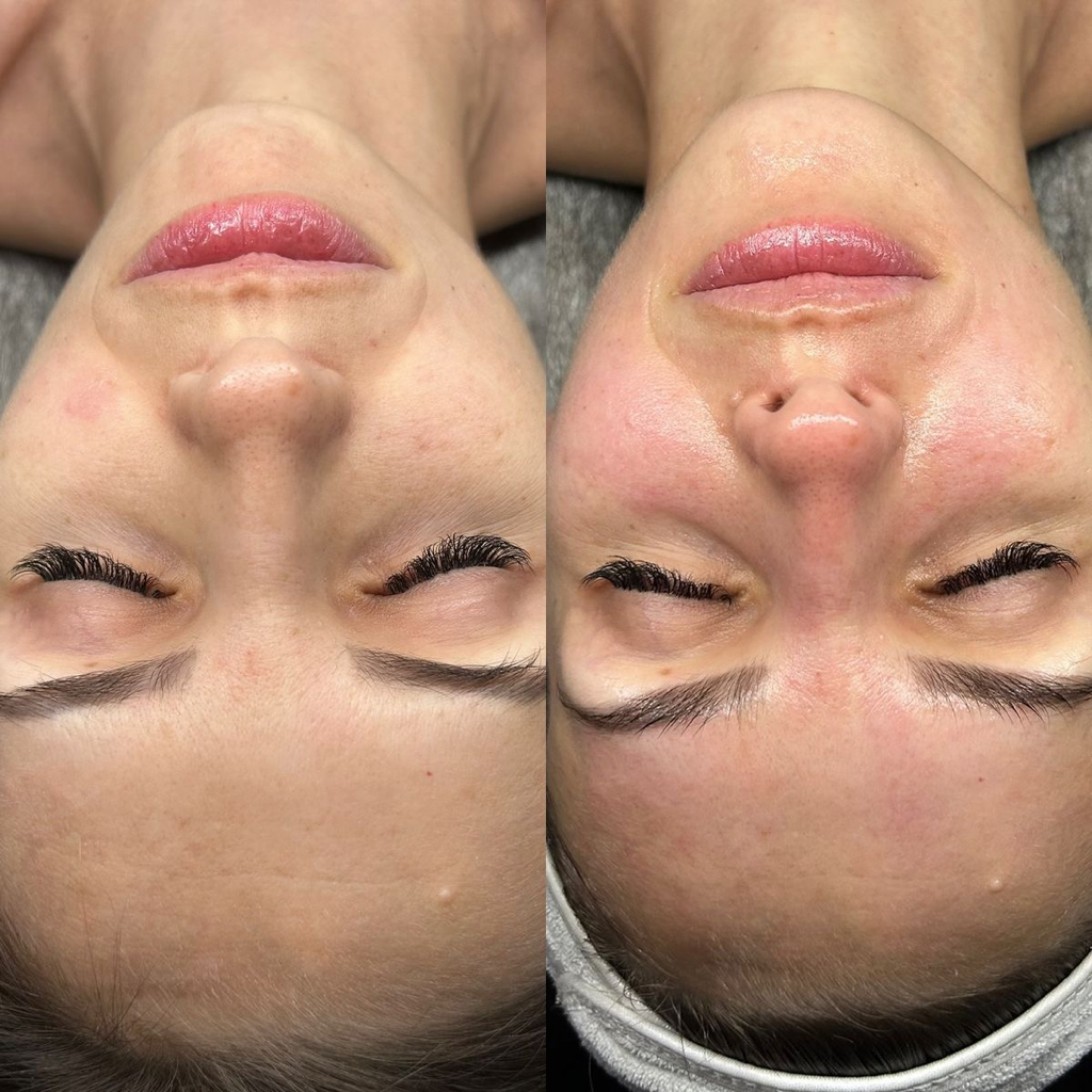 Всё включено: УЗ-чистка, пилинг, маска, крем 🎁