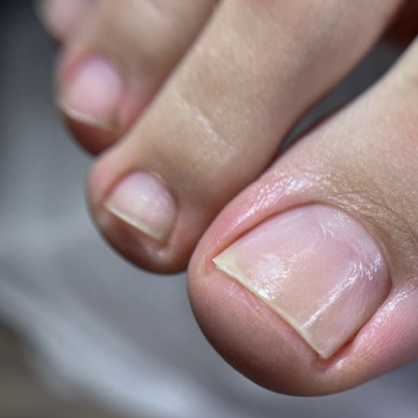 педикюр обработка пальчиков