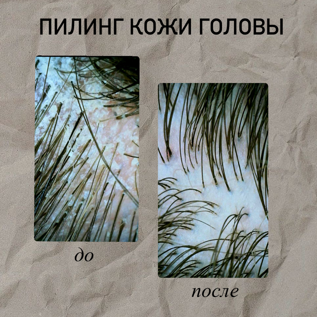 Пилинг +мытье головы+ стрижка кончиков