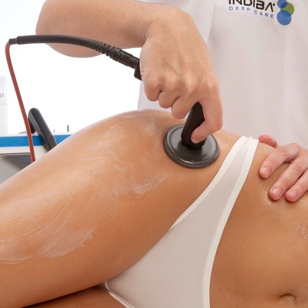 Индиба (коррекция фигуры): 30 мин живот + 30 мин ягодицы,ноги