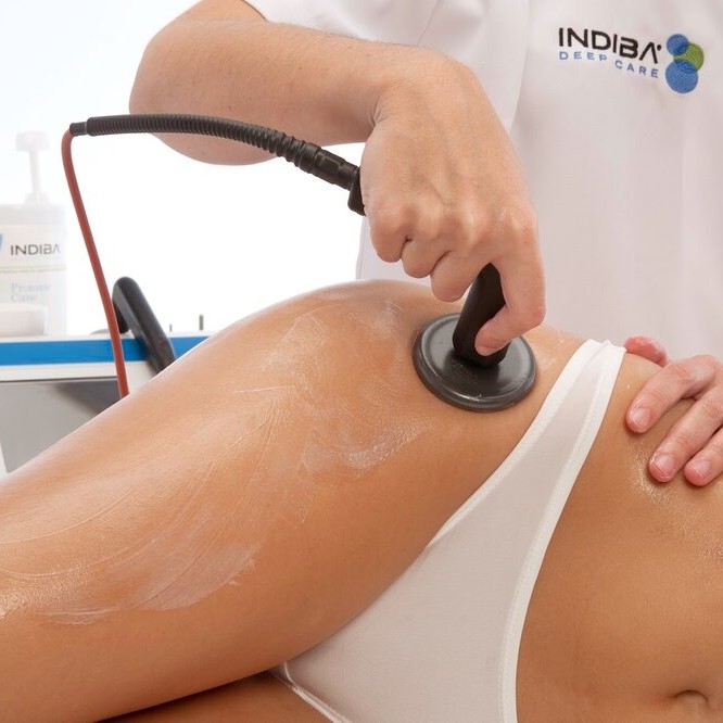 Индиба: бёдра, ягодицы 30 мин