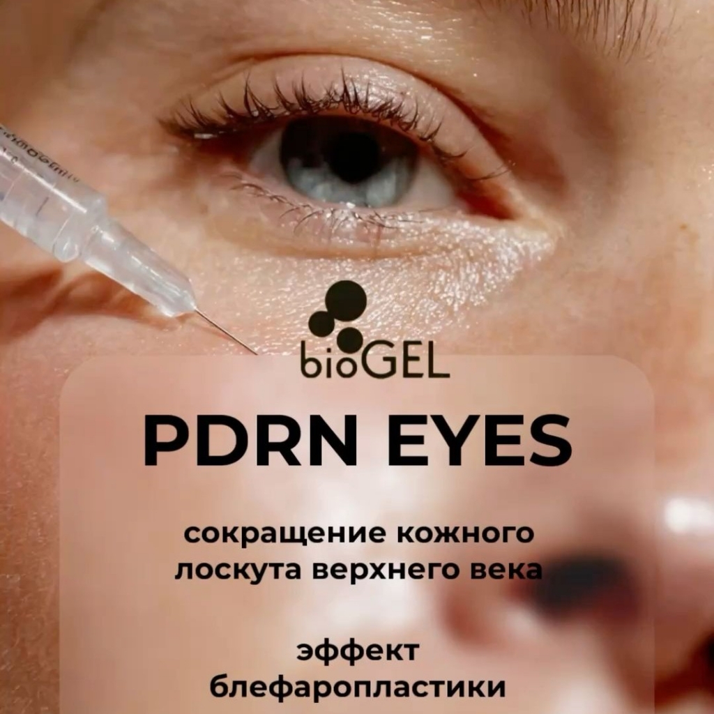 Биоревитализация век PDRN eyes