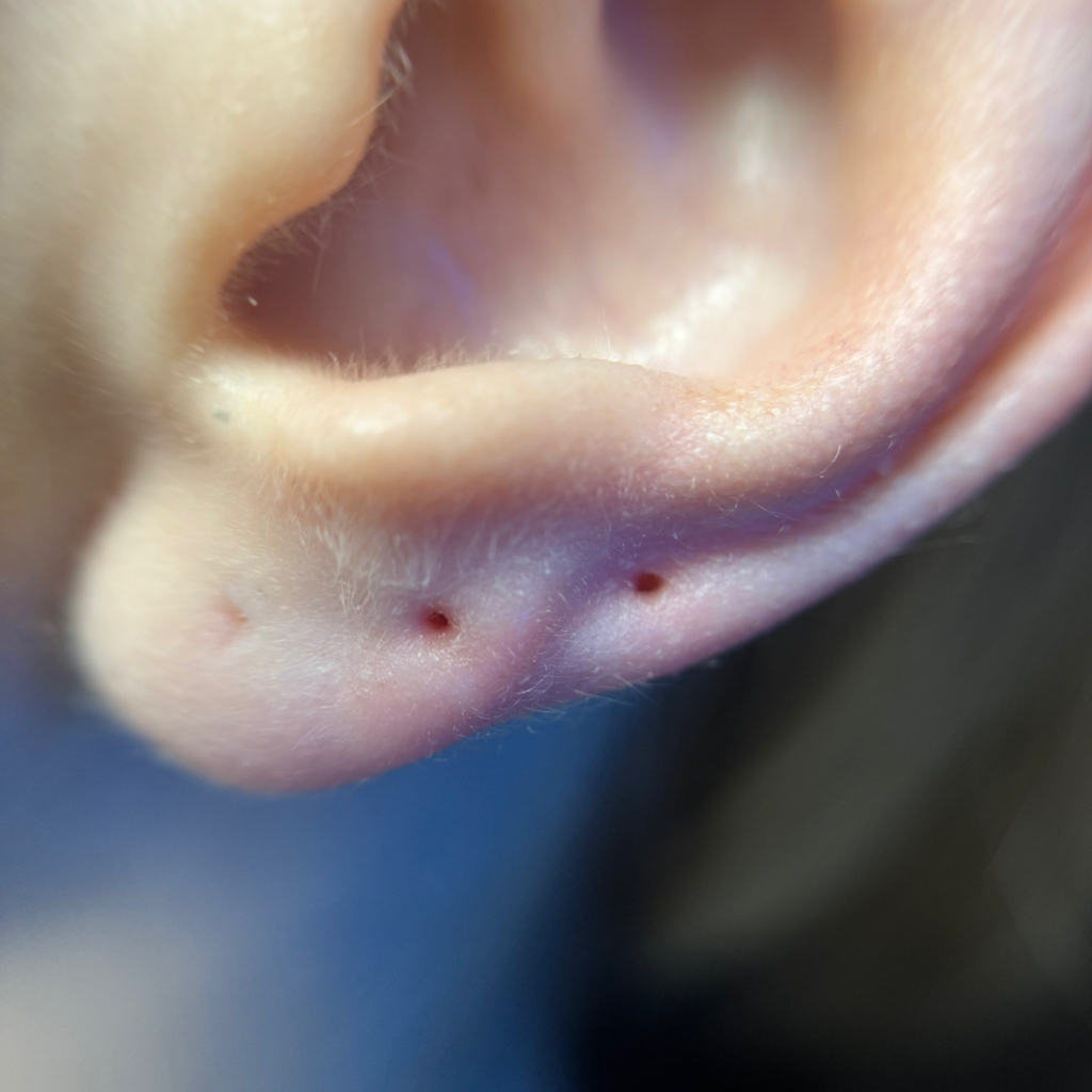 Консультация по проколам