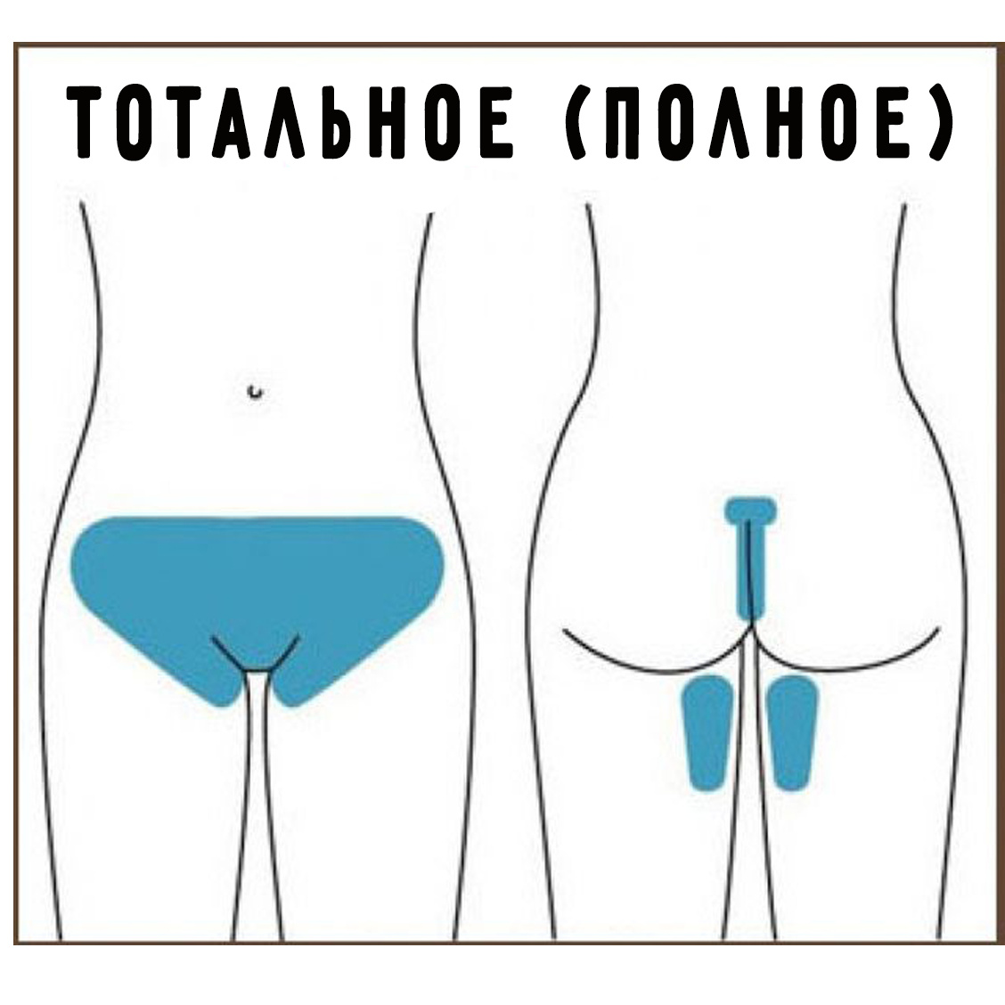Бикини тотальное