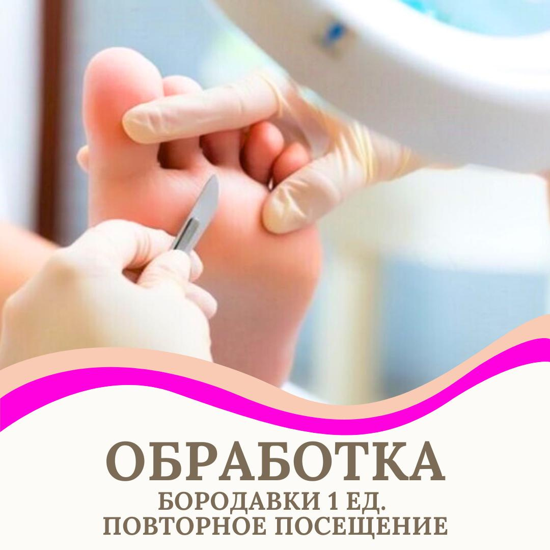 Обработка бородавки 1 ед.повторное посещение