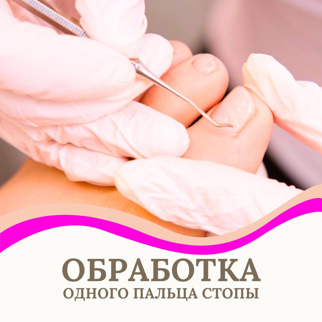 Обработка  1-го пальца стопы(первичное посещение)Онихолизис/онихомикоз/травма/утолщение с консультацией