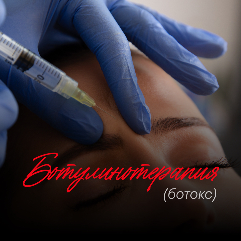 Ботулинотерапия Full Face