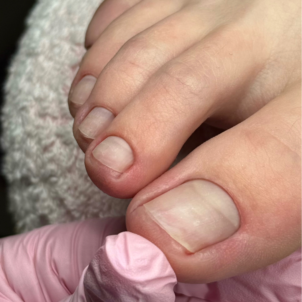 Педикюр  мужской