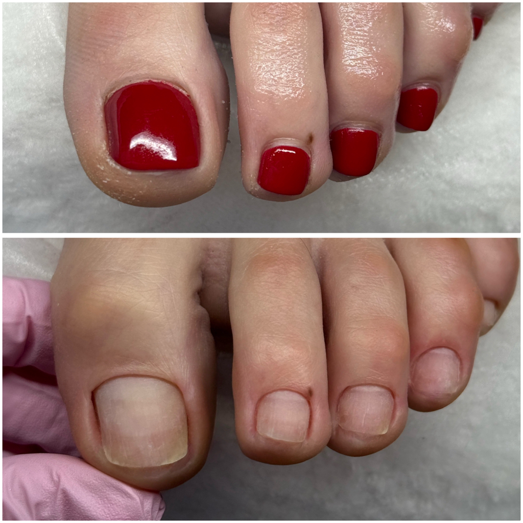 Мини педикюр женский (без покрытия, без обработки стопы)