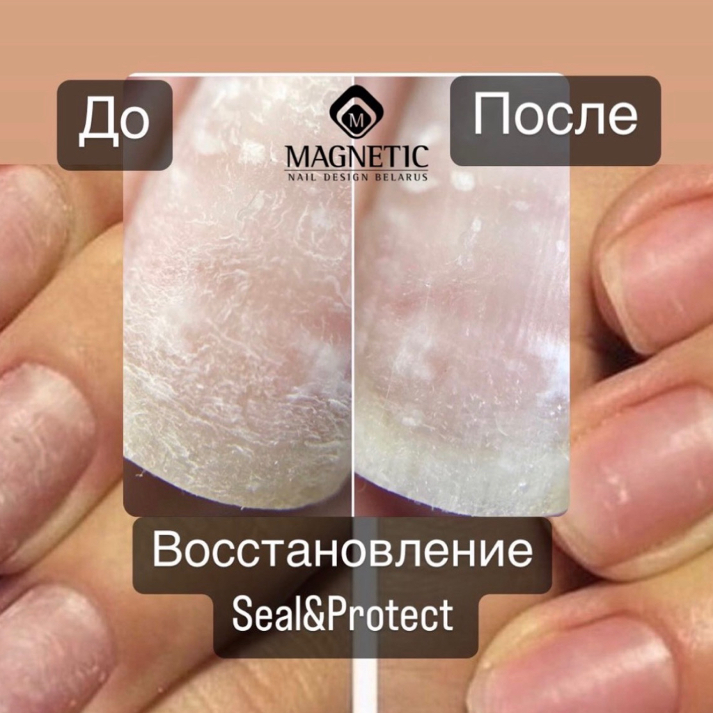 Восстановление ногтевой пластины Magnetic Seal&Protekt