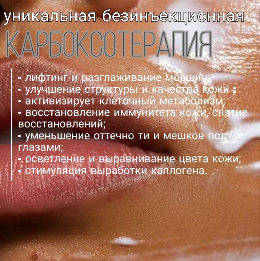 Карбоксотерапия